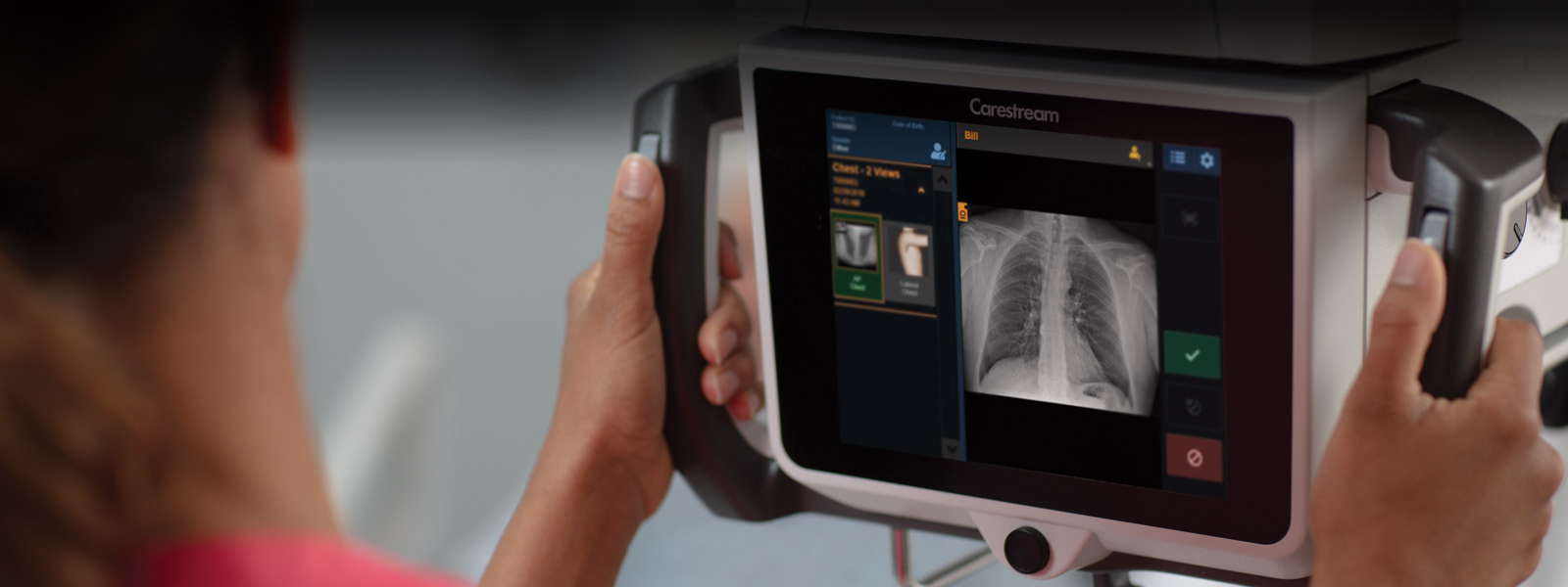 CARESTREAM ImageView 软件