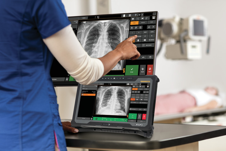 gallery2-piu-mobile-xray-mobile-retrofit-6